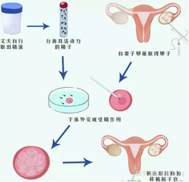 多次做借卵赠卵试管代生移植失败的原因是什么？