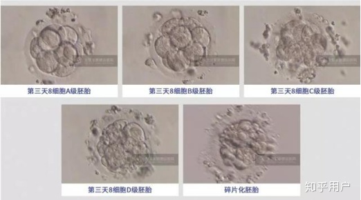 宫腔镜检查后多长时间可以做借卵代怀试管？