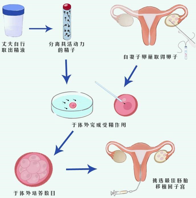 哪有试管代怀让我随心所育