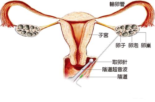 不来月经能做长沙试管吗