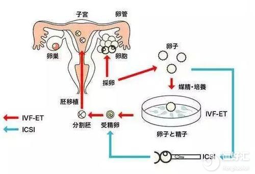 你知道第3代试管代怀包生男孩提高想找一个试管代怀女植入的秘诀吗