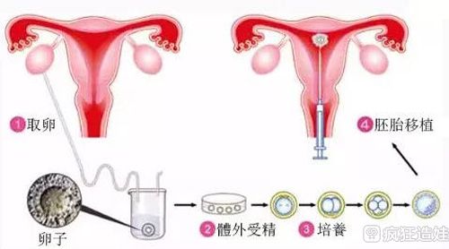 长沙ibaby生殖医院试管代怀公司排名费用多少钱（长沙ibaby生殖医院）